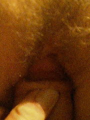 Photo 1, closeup hairy vagina