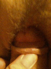 Photo 1, closeup hairy vagina