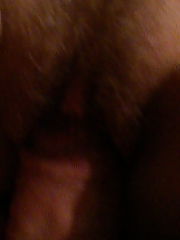Photo 1, closeup hairy vagina