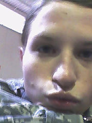 Photo 1, deep rectal