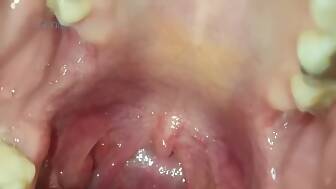 large throat huge mouth