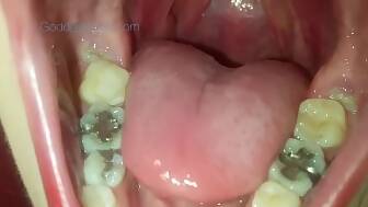 large throat huge mouth