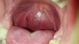large throat huge mouth