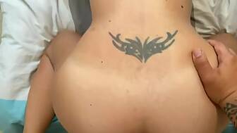 rectal butt